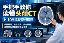 手把手教你读懂头颅CT，10节完整视频课程——急诊科神经内科临床医师必备的颅脑CT读片系统教程 MP4